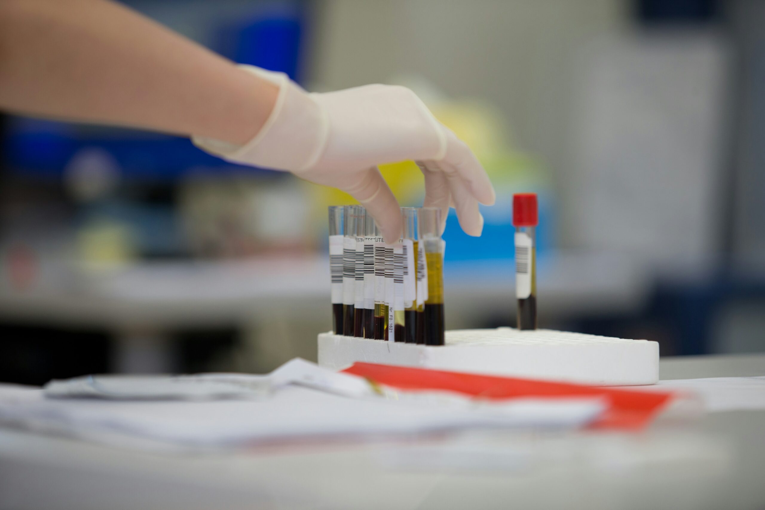 Lp(a) Test: The Number Most Doctors Miss