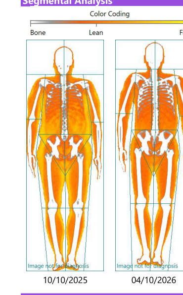 Two iDXA body composition scans side by side. October 2025 scan on the left at 247 pounds shows substantial fat (orange) overlaying lean tissue. April 2026 scan on the right at 209.5 pounds shows visibly less fat and more defined lean mass, with the same color-coded format.