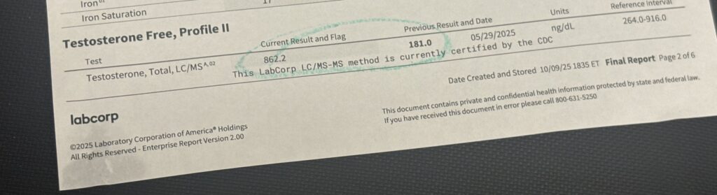 Section of a Labcorp lab report titled 'Testosterone Free, Profile II,' photographed on a dark surface. The row shows Testosterone, Total, LC/MS with a current result of 862.2 ng/dL and a previous result of 181.0 ng/dL from 05/29/2025, with the two values circled in green. The reference interval column on the right shows 264.0 to 916.0 ng/dL. The Labcorp logo is visible at the bottom left.