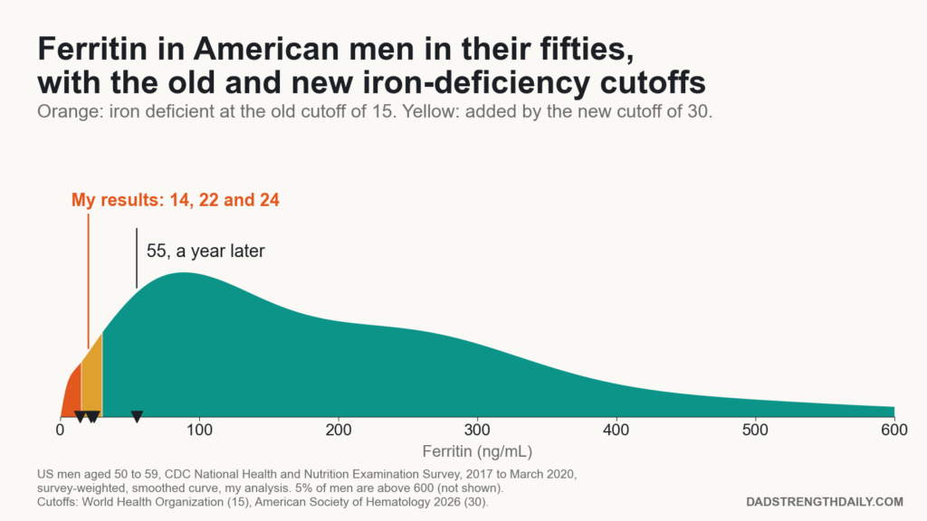 Chart of ferritin levels in US men aged 50 to 59 with the old iron-deficiency cutoff of 15 and the new cutoff of 30. The author's results were 14, 22, 24 and 55.